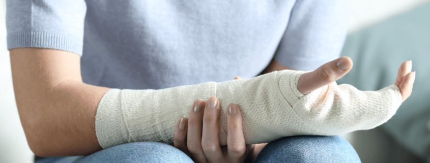 Foto de una persona con la mano escayolada, que ilustra el artículo "El despido disciplinario encubierto durante las fases finales de IT" de Ponter Abogados y Asesores